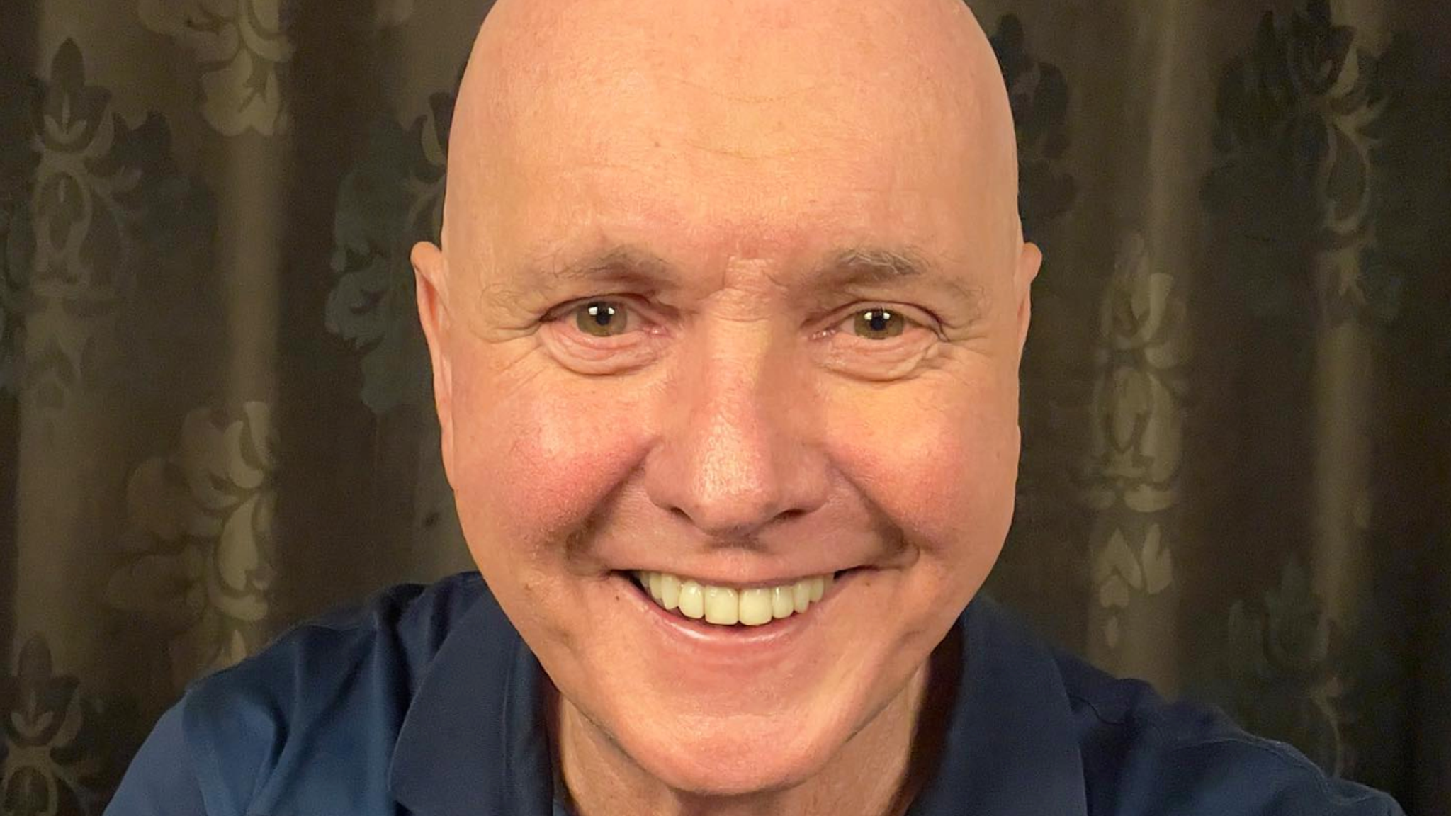 Why is karl kennedy bald