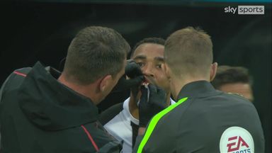 OUCH - tooth agony for Premier League stars!