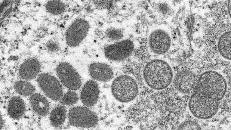 Monkeypox virus particles. Pic: CDC