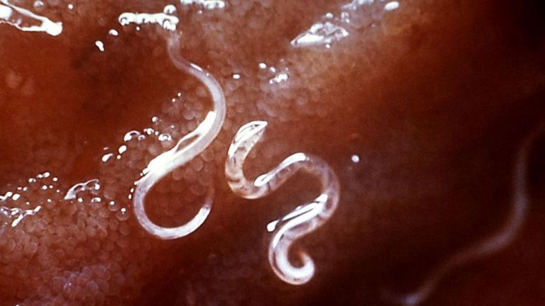 A Hookworm is a parasite that infects the intestines (file pic)