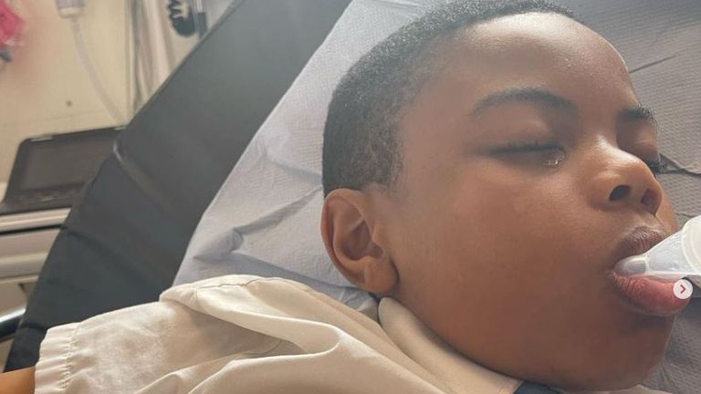 Raheem Bailey lost a finger after an attack by a group of children at school, his mother Shantal Bailey says. Pic: @muslima_vegan/Instagram

