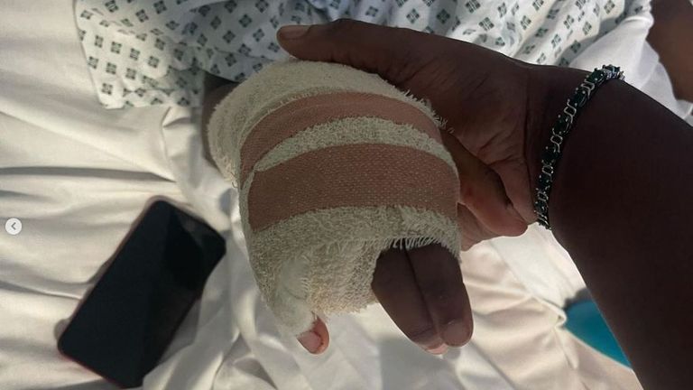 Raheem Bailey lost a finger after an attack by a group of children at school, his mother Shantal Bailey says. Pic: @muslima_vegan/Instagram
