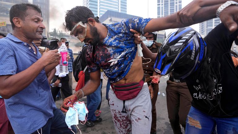 Sri Lankan protesters against the government help an injured colleague  beaten up by Rajapaksa supporters during a clash at the ongoing protest site outside president&#39;s office in Colombo, Sri Lanka, 