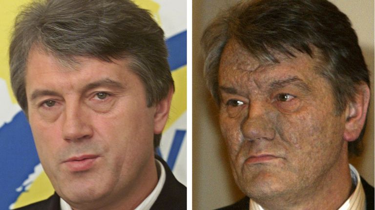 Pro-EU Ukrainian presidential candidate Viktor Yushchenko in 2002 and 2004, before and after his alleged poisoning. Pic: AP 