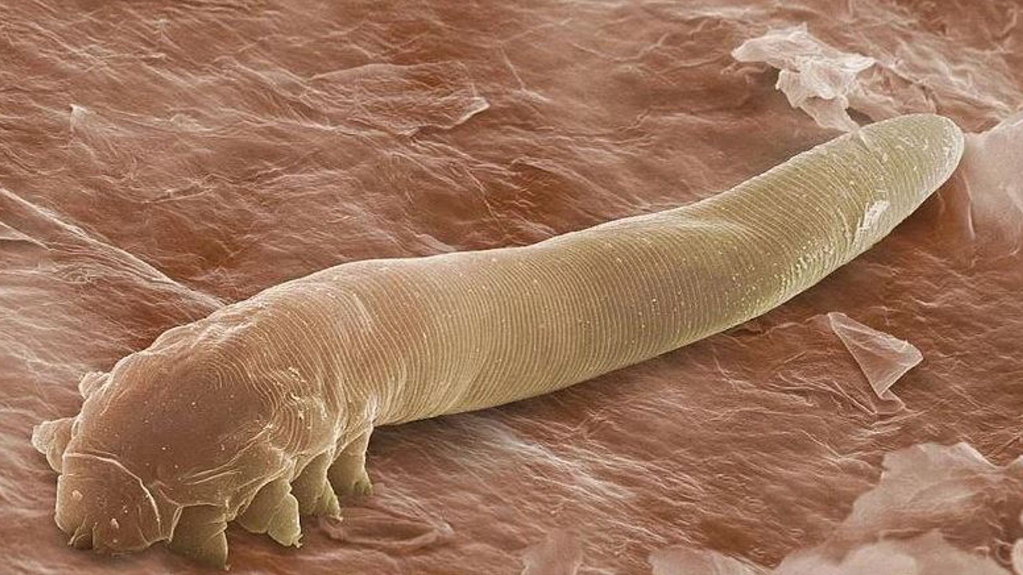 worm under microscope real