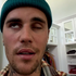 Justin Bieber yüzünün yarısı felçliyken Ramsay Hunt sendromuna yakalandı | Entler ve Sanat Haberleri