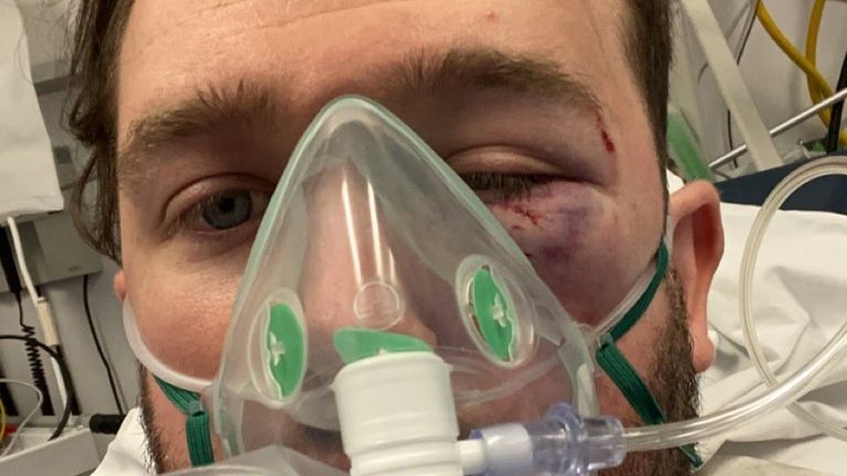 Evan Somers was subjected to a homophobic attack as he left a night out in Dublin