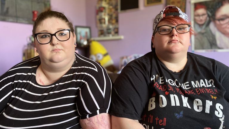 Katie (L) and her partner Jamie (R) were hurt by the time they had to wait in A&E 