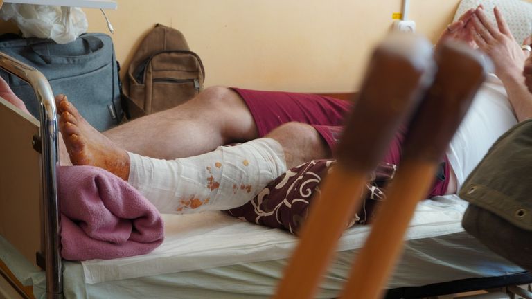 Doğu Ukrayna'daki bir hastanede yaralı asker.  Bohdan, Mart ayında Luhansk bölgesindeki Rubizhne'de şarapnel tarafından vurulmuştu. 