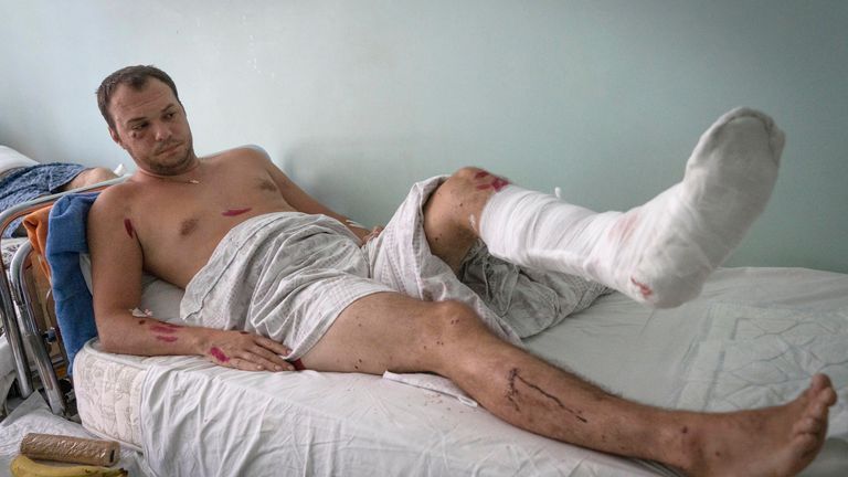 2022 年 6 月 28 日，星期二，乌克兰波尔塔瓦地区克列门丘克市一家医院的床上，一名因俄罗斯致命火箭弹袭击而受伤的男子躺在床上。（美联社照片/Efrem Lukatsky）图片：美联社