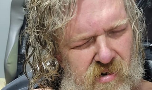 Man dies after sister woke from two-year coma to name him as her attacker - Vimarsana News