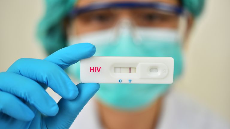 Lab technician holding HIV rapid device test, the result showed positive. Pic: iStock