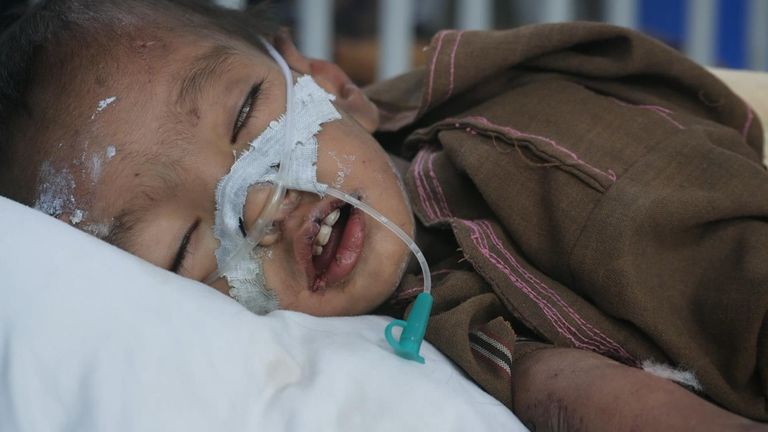 Afganistan'da çocuk hastanesi