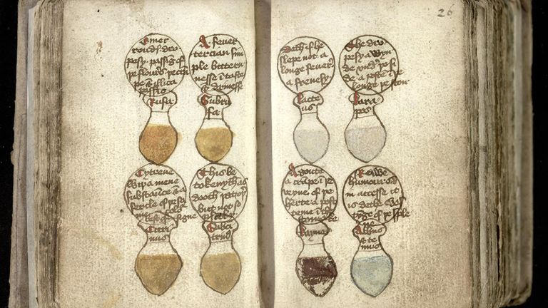 An undated handout released by the University of Cambridge Library with drawings of urinals, illustrating different colors of patient urine, with their ailments depicted in circles above.  Unusual medieval cures, including a gout treatment that involves baking an owl then grinding it into a powder, will be shared with the public online by Cambridge University Libraries.  Release date: Wednesday, August 17, 2022.