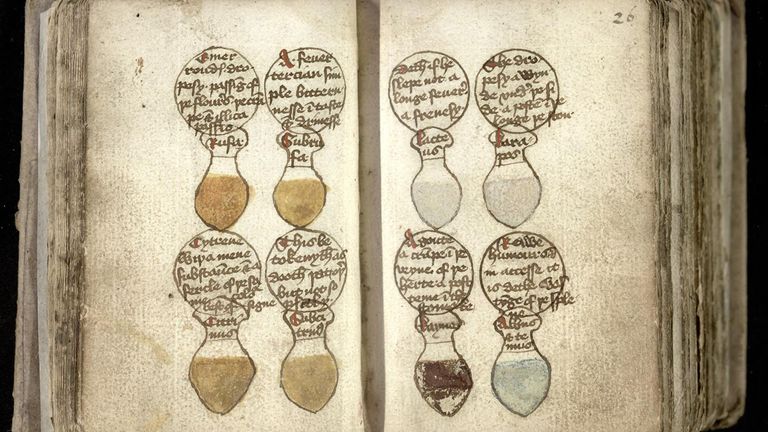 An undated handout released by the University of Cambridge Library with drawings of urinals, illustrating different colors of patient urine, with their ailments depicted in circles above.  Strange Medieval cures, including a gout treatment that involves baking an owl then grinding it into a powder, will be shared with the public online by Cambridge University Libraries.  Release date: Wednesday, August 17, 2022.