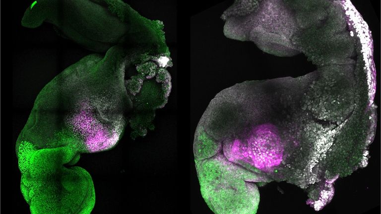 Natural and synthetic embryos side by side to show comparable brain and heart formation. Pic: Credit: Amadei and Handford



