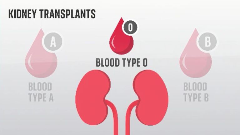 Cambridge University scientists have successfully changed the blood types of three donated kidneys - a breakthrough that could increase the supply of kidneys available for transplant, especially for ethnic minorities less likely to find a suitable kidney.