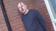 Police bodycam footage showed Jamie Crosbie covered in blood. Pic: Norfolk Police