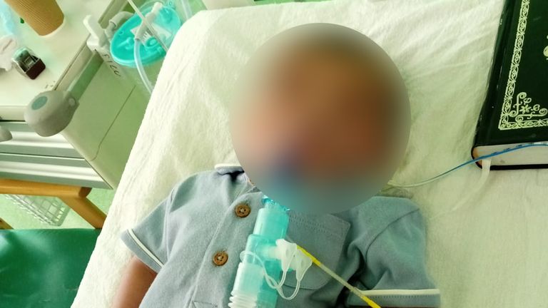 The baby began breathing two weeks after he was declared brain dead
