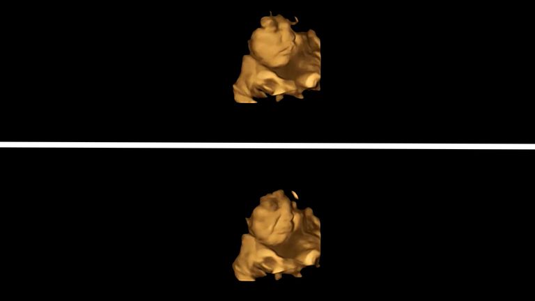 EMBARGOED TO 0001 THURSDAY SEPTEMBER 22 Undated Durham University handout image of a 4D scan of a fetus showing a neutral face (top) and the same fetus showing a cry-face reaction (bottom), after being exposed to the kale flavour. Issue date: Thursday September 22, 2022.

