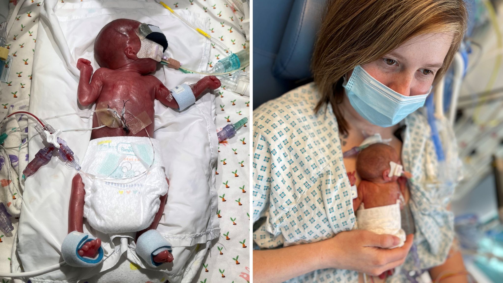 Baby born cheap 23 weeks