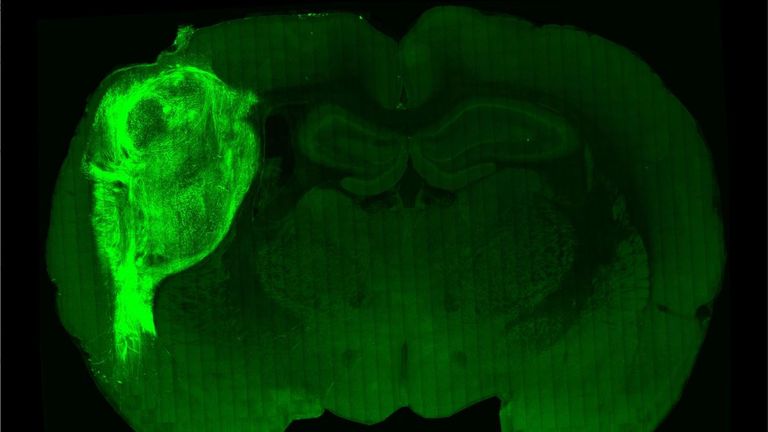 A transplanted human organoid labelled with a fluorescent protein in a section of the rat brain. Pic: Stanford University.

