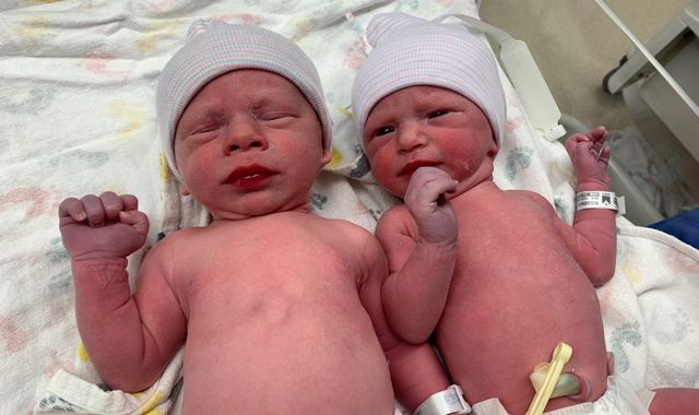 Twins born from embryos frozen 30 years ago believed to be a new record - Vimarsana News
