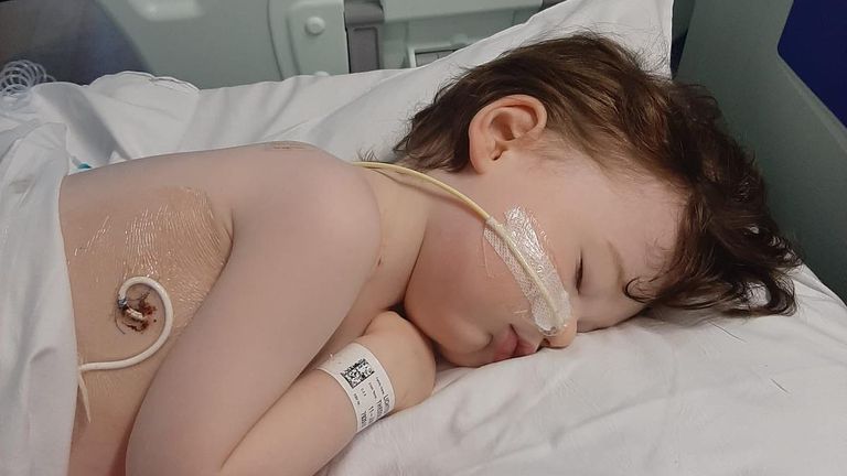 Teddy, 3, at the start of treatment