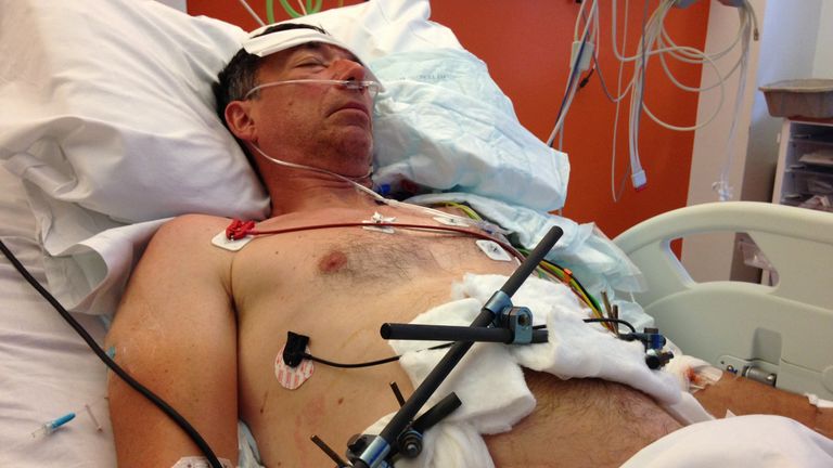 Graham Hills spent 102 days in hospital after being hit by an uninsured car. Pic: Graham Hills
