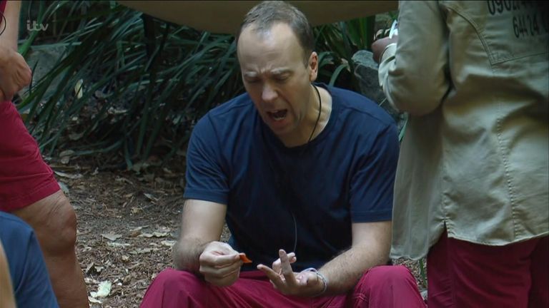 Matt Hancock is stung by a scorpion on I'm A Celebrity... Get Me Out Of Here!
