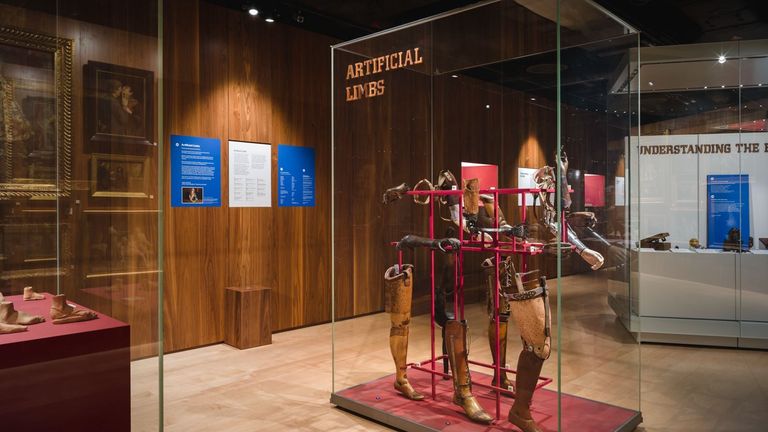 London museum shuts ‘racist and sexist’ medical history exhibition