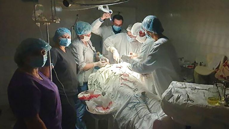 Ukraynalı doktor Oleh Duda tarafından kullanıma sunulan bu fotoğraf, 15 Kasım 2022 Salı, Ukrayna'nın batısındaki Lviv kentindeki hastanede kanayan bir hastayı karmaşık ve tehlikeli bir şekilde ameliyat ederken hastanedeki ışıkların söndüğü anı gösteriyor. Rusya'nın Ukrayna'nın elektrik şebekesine yönelik yıkıcı saldırıları, yıllarca süren yolsuzluk, kötü yönetim, COVID-19 salgını ve dokuz aylık savaş nedeniyle halihazırda hırpalanmış olan ülkenin sağlık sistemini gerdi ve bozdu.  (AP yoluyla Oleh Duda)