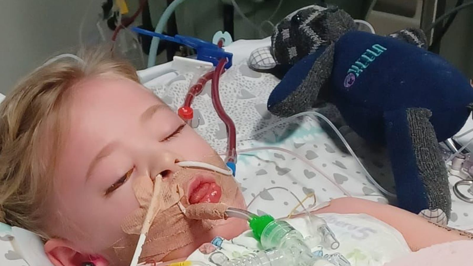 Strep A infection leaves four-year-old girl fighting for her life in Liverpool hospital