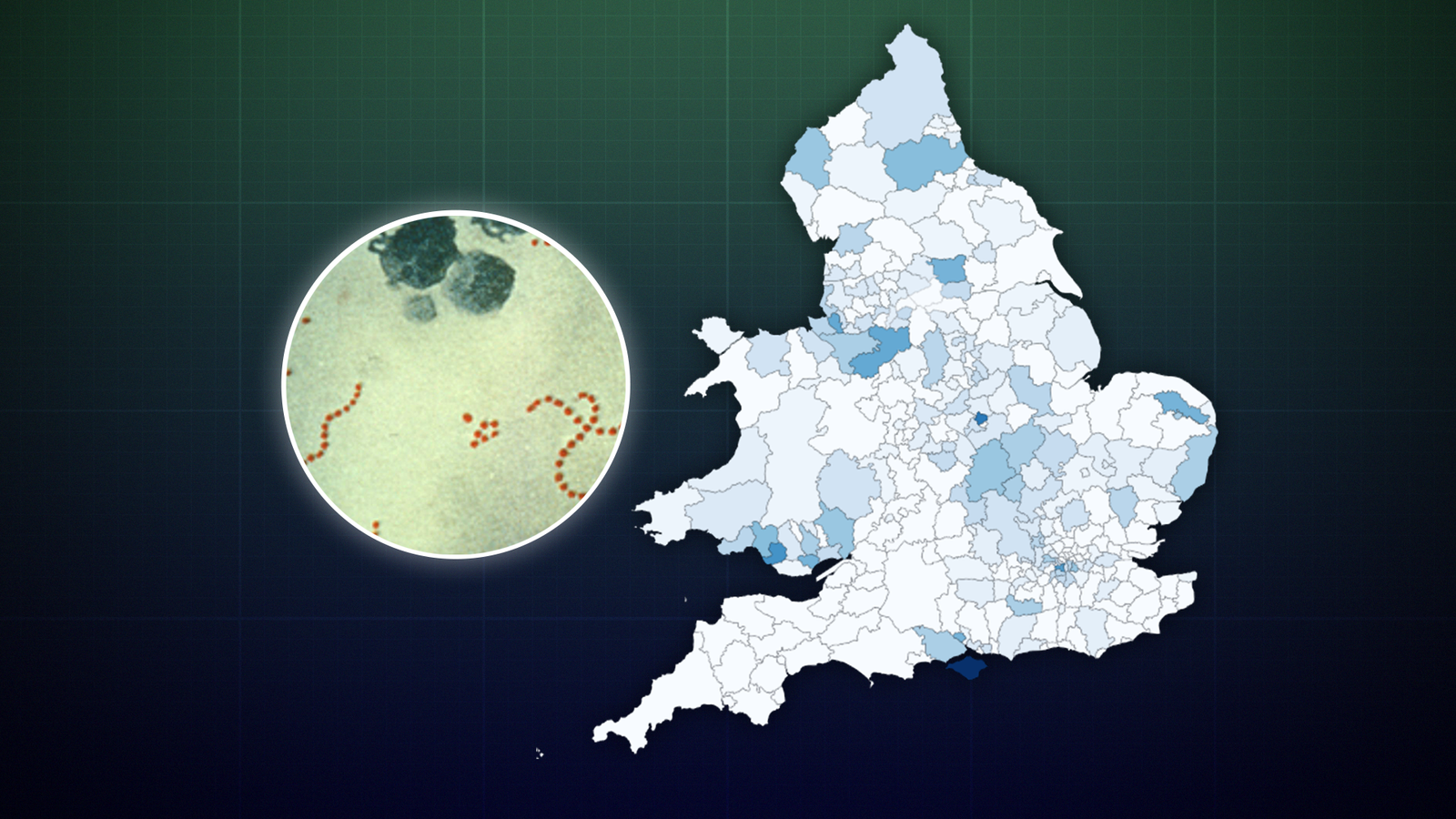 Strep A: Find out how many severe infections and scarlet fever cases are in your area | UK News