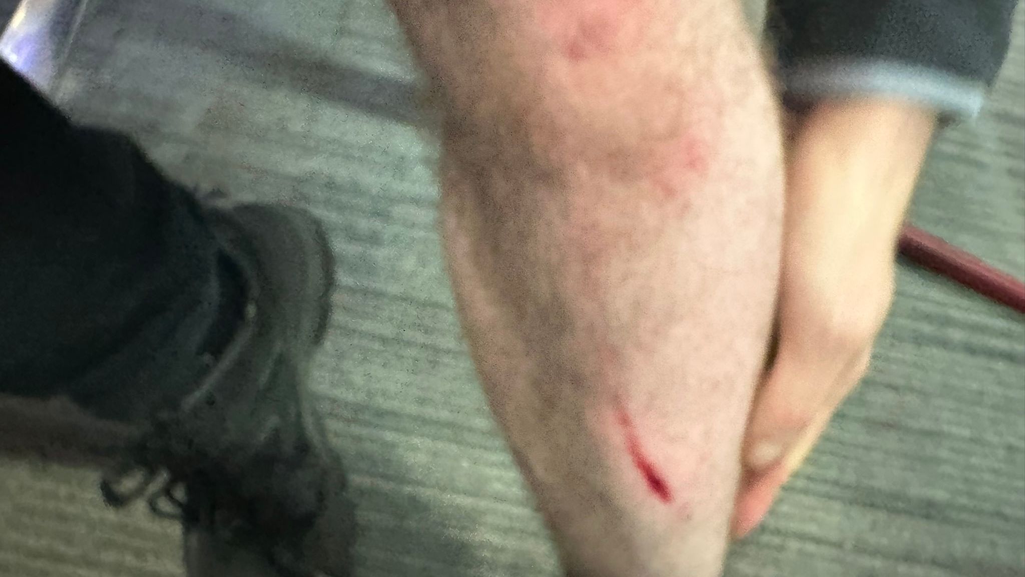 Blind BBC reporter Sean Dilley chases and sits on mugger who stole his