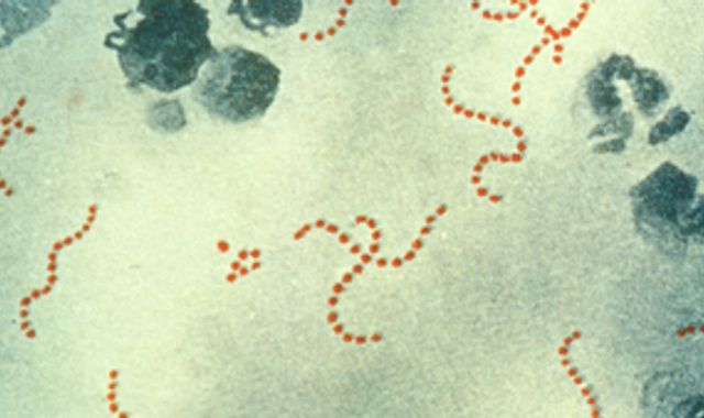 Strep A: 'Invasive' form of infection linked to death of four-year-old in Ireland - Vimarsana News