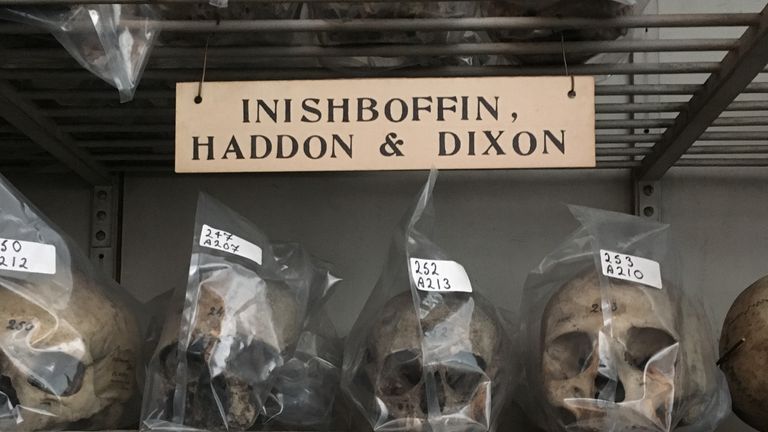 The stolen skull collection in Trinity College Dublin. Pic: Ciaran Walsh
