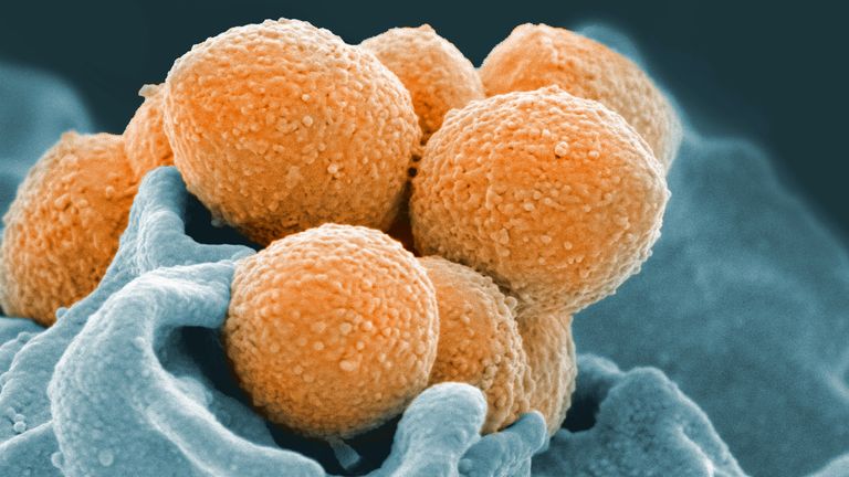 An electron microscope image of Group A Streptococcus. Pic: AP