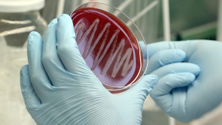 A microbiologist at the Max-Planck-Institute for Infection&#39;Biology prepares a bacterial colony of the strain Streptococcus pyogenes on a blood agar plate
PIC:AP