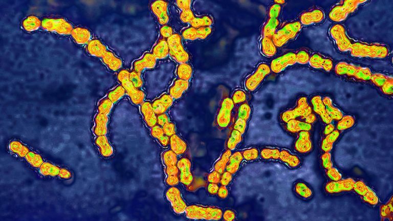 Group A Streptococcus 