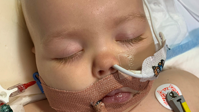 Bella Hessey, 3, needed lifesaving treatment with immunoglobulin after developing Kawasaki disease as a baby