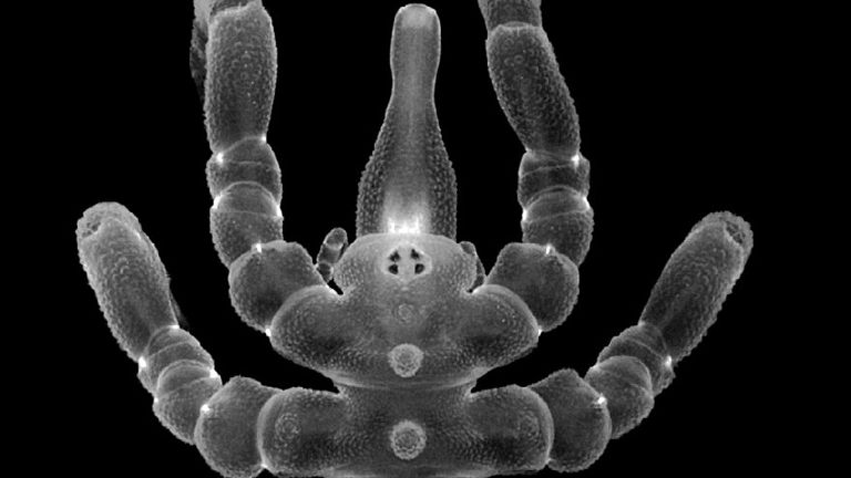 'Nobody expected this': Scientists stunned by spiders who can regrow lost anuses