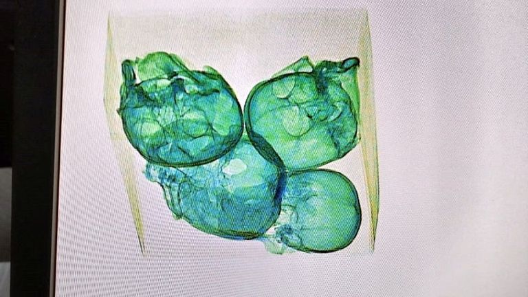 Four human skulls encased in plastic and aluminum foil were discovered by X-ray equipment during a National Guard inspection