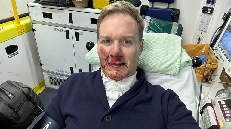 Dan Walker posts pictures on his twitter after he was involved in an accident with a car while riding his bike 