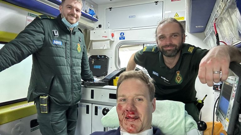 Dan Walker posted a photo on his twitter after he was in an accident with a car while cycling