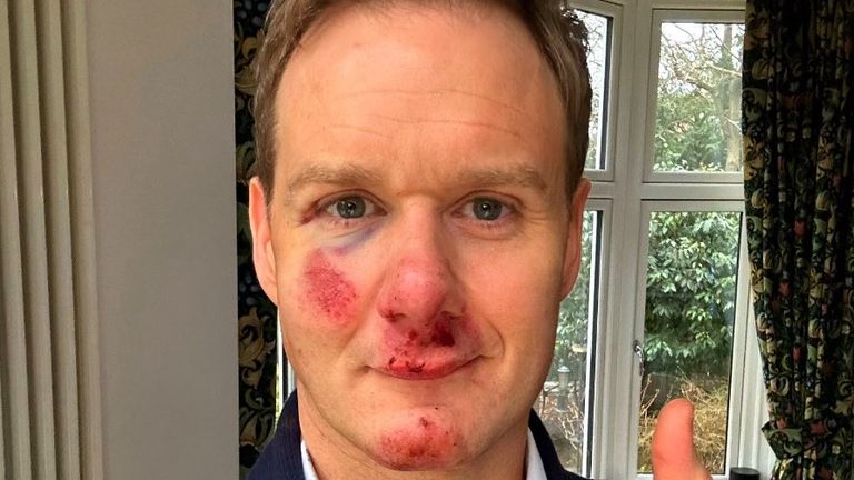 Screengrab from twitter after bike crash. Pics: @mrdanwalker