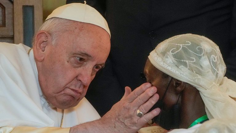 Pope Francis caresses a victim of violence. Pic: AP