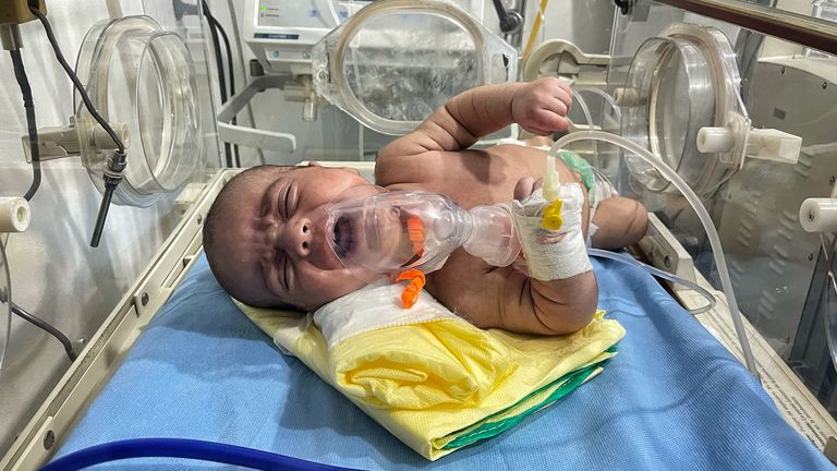 A crying baby at the Shams hospital