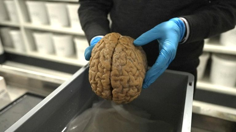 One of nearly 9,500 brains kept in buckets for scientific study in Denmark