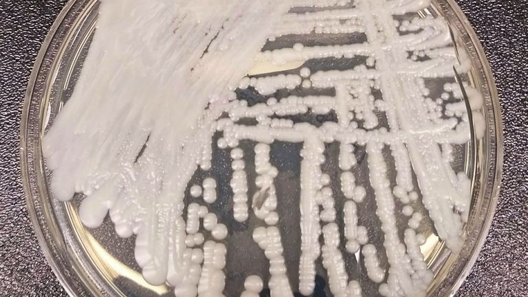 This undated handout photo obtained by Reuters on April 9, 2019 shows a strain of Candida auris growing in a petri dish at the Centers for Disease Control and Prevention (CDC). CDC/Handout via Reuters Attention Editors - This image was taken by a third party